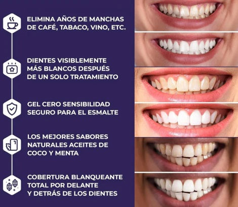 Bandas Blanqueadora Dientes 3d White