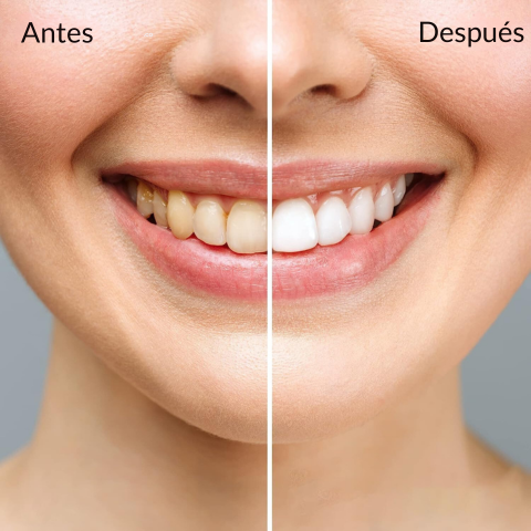 Bandas Blanqueadora Dientes 3d White